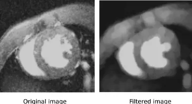 Example of morphological filtering